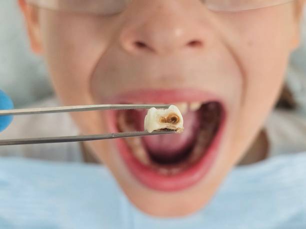 Best Emergency Denture Repair in Tilden, NE